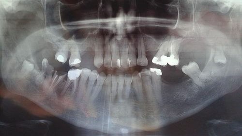 Featured Image